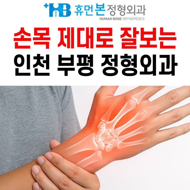 손목 석회성건염 부평역정형외과
