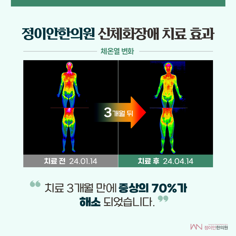신체화장애 더이상 방치하면 안 돼요.