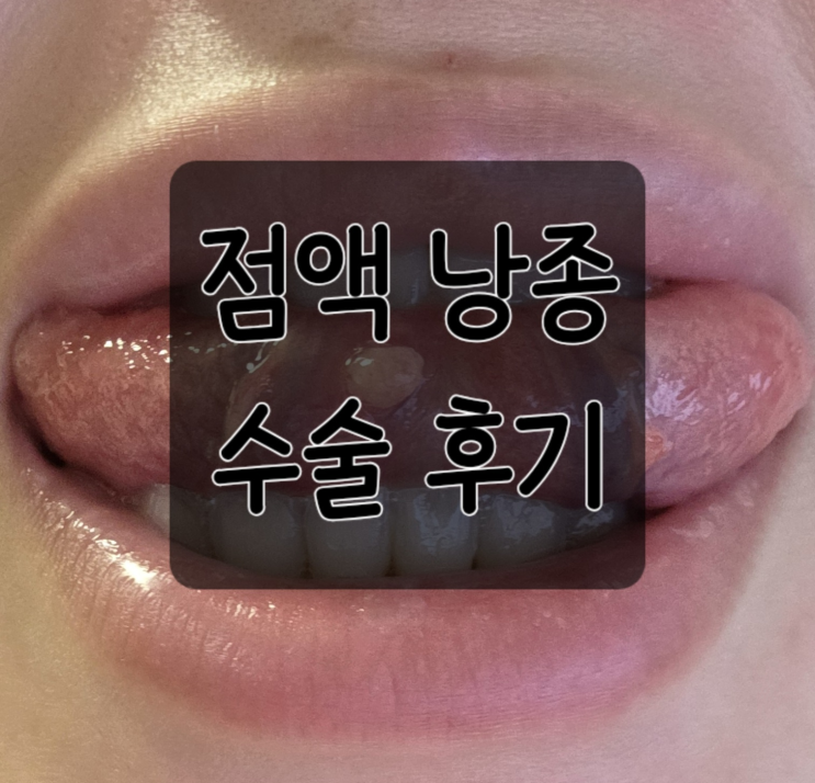  혀 밑 물집(점액낭종) 대학병원 안 가고 제거한 솔직 후기 (ft. 극악의 마취 통증)