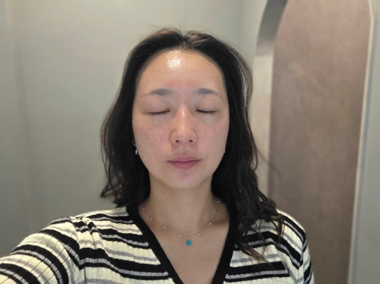  이천피부관리 리프팅 무제한 샷 가능한 리윤에스테틱