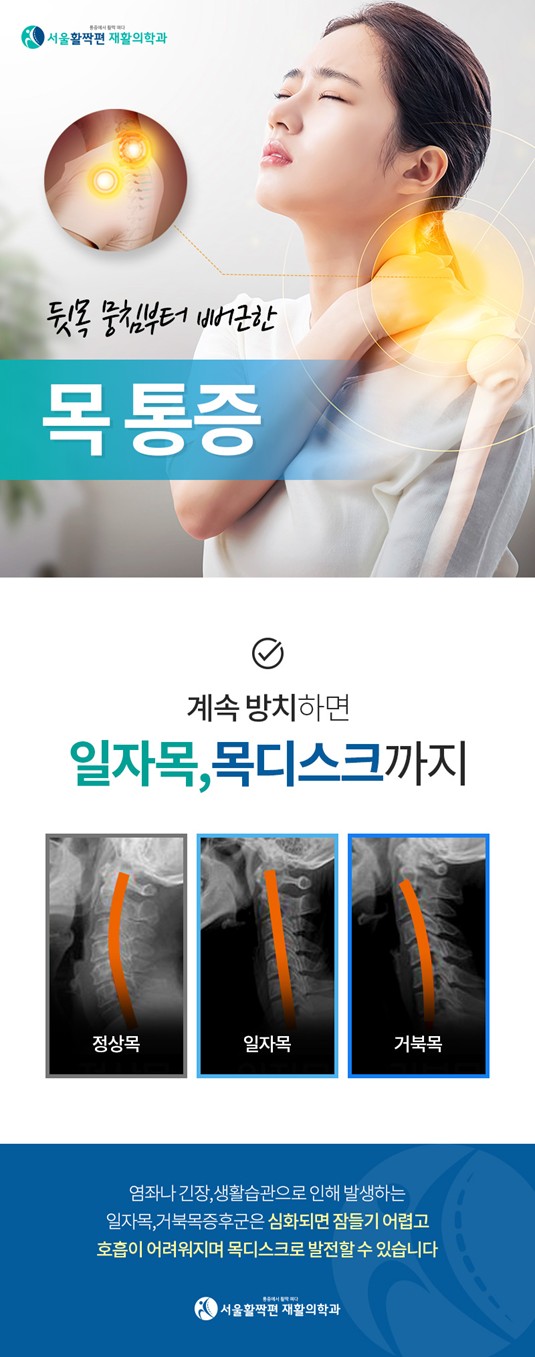 Differentiating cervical spine–related symptoms from carpal tunnel syndrome — 본문 그림