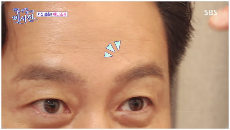  이서진 이마 흉터에 숨겨진 드라마 애니아빠 신세계 가족과의 특별한 인연