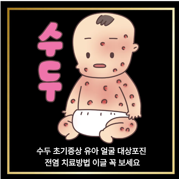  수두 초기증상 유아 얼굴 대상포진 전염 치료방법 이글 꼭 보세요