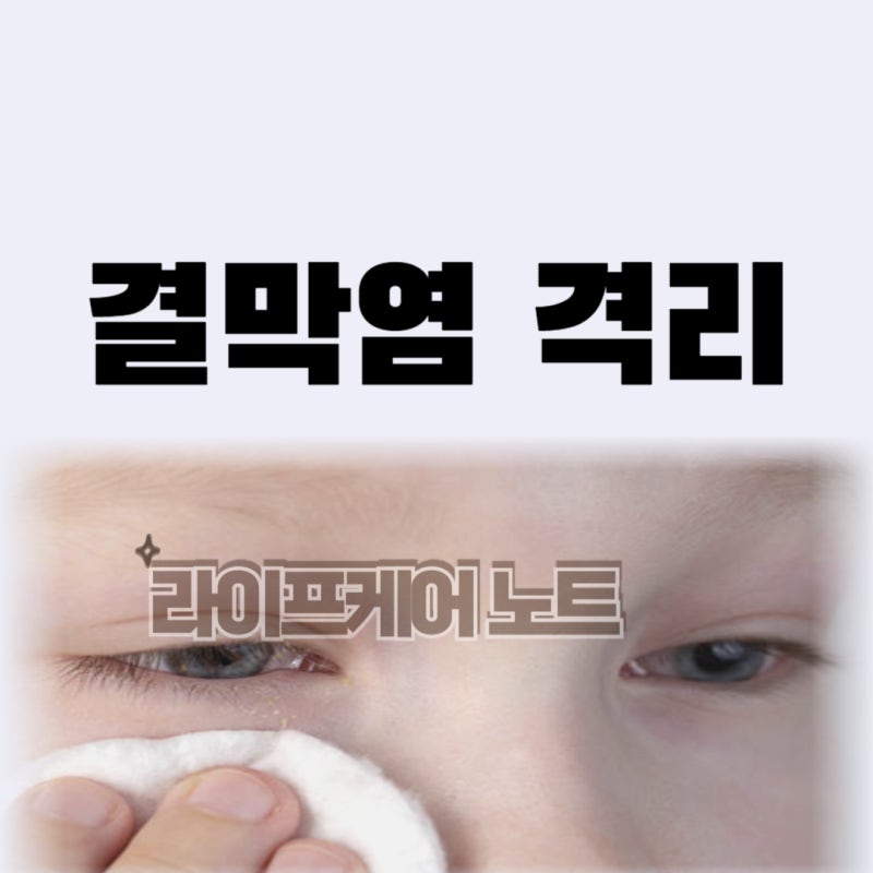 유행성 결막염 격리 며칠이나? 출근, 등교 기준 한 번에 정리