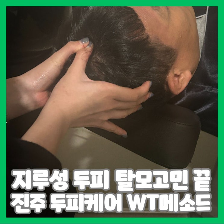  진주두피케어 WT메소드 지루성 탈모 고민 끝
