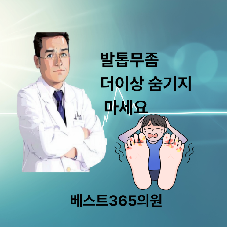 청주 발톱무좀 이제 숨기지 마세요
