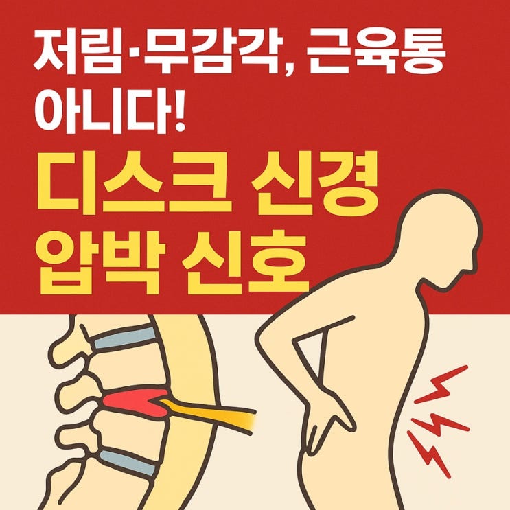   목·허리 디스크, 신경 증상과 연결되는 진짜 이유