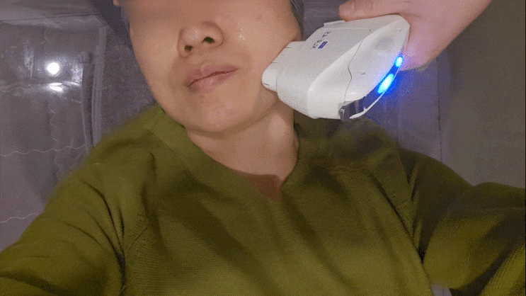  강남 신논현, 울쎄라 대신 ‘울트라인’으로 턱선 찾기