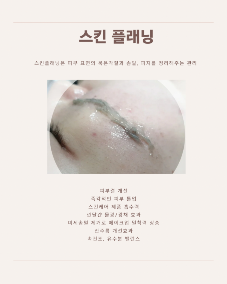  광주 광산구 수완동 12월 스킨플래닝 할인 가격 알려드려요.