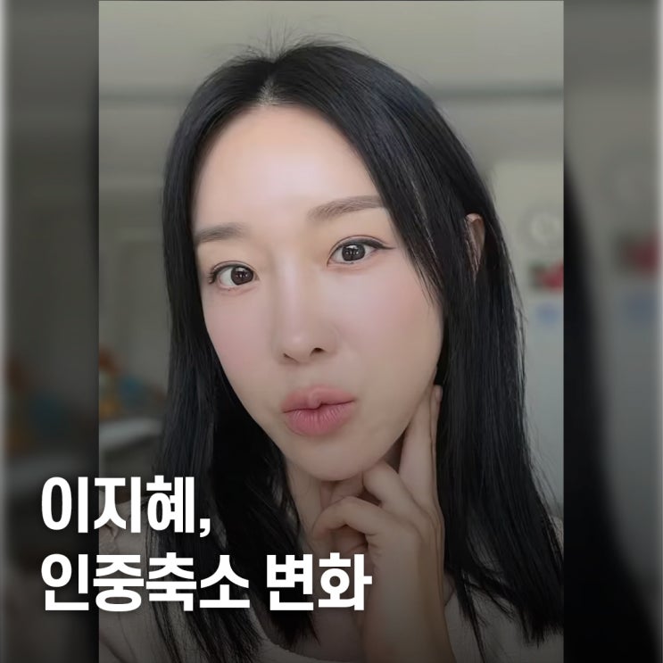  “동안 효과라더니..” 이지혜 인중축소, 실제 비용·부작용 총정리