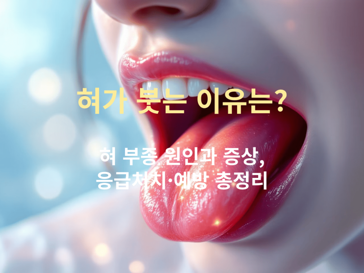  혀가 붓는 이유는? 혀 부종 원인과 증상, 응급처치·예방 총정리