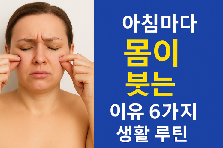  아침만 되면 얼굴이 붓는 이유,  6가지 /