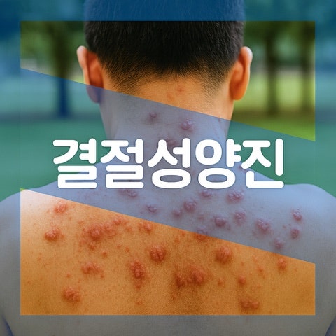 결절성양진 초기 원인, 감염 특징 관리법 알아보자