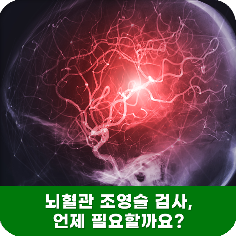 뇌혈관 조영술 검사, 언제 필요할까요? 검사 전·후 꼭 알아야 할 사항