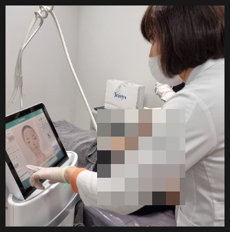  홍대 울쎄라 600샷 맞고 후회하지 않으려면