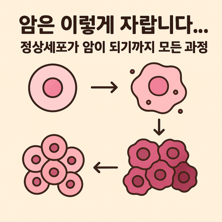   암 발생 과정 단계별 설명｜정상세포가 암세포가 되기까지