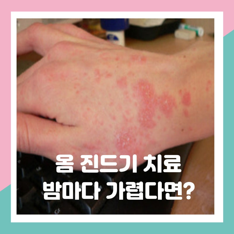 옴 진드기 치료 증상 원인 후기 밤에 이유없이 가렵다면 의심해야