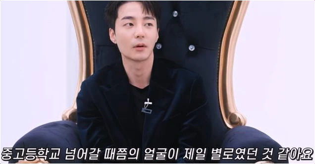 로이킴 성형 논란, 사춘기가 만든 반전 얼굴의 진실!
