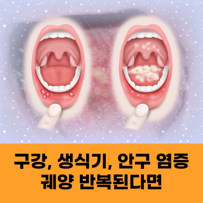 서울 베체트병 혈액 검사로 알 수 있는 정보는?