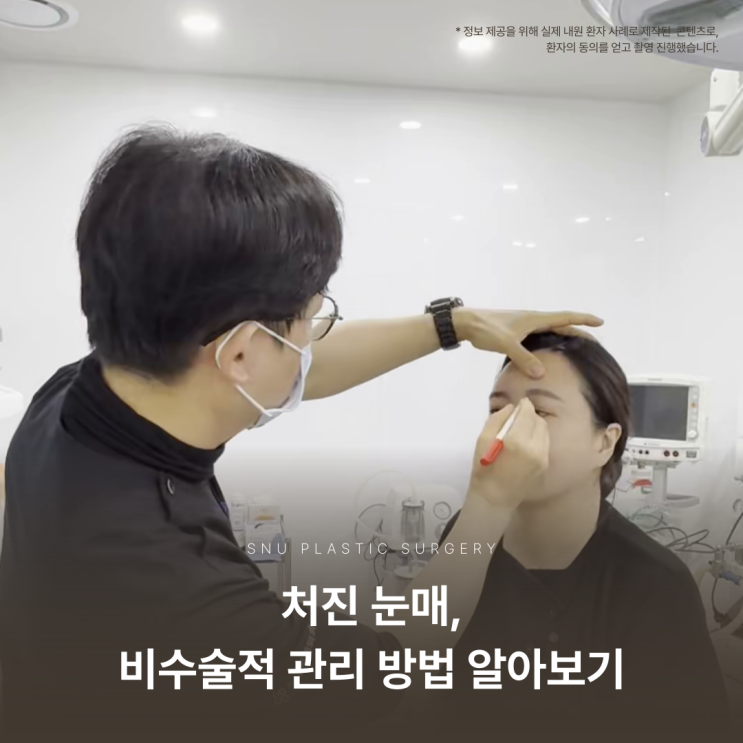  스누성형외과｜눈썹거상 실리프팅으로 처진 눈매를 또렷하게