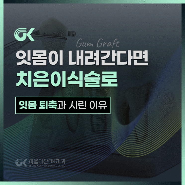  강일역치과, 치은이식술이 필요한 경우