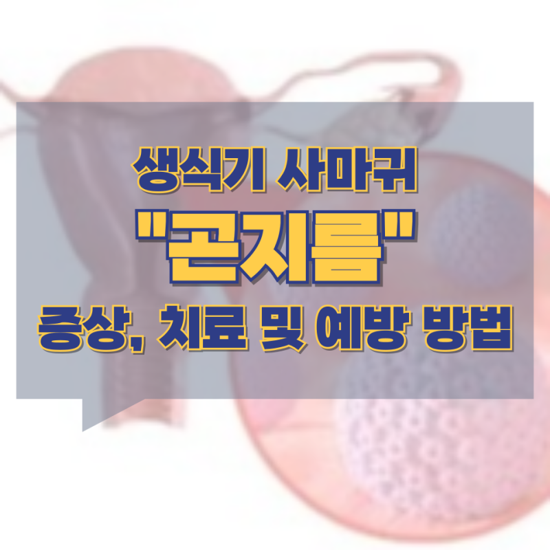 생식기 사마귀 "곤지름" 증상, 치료 및 예방 방법