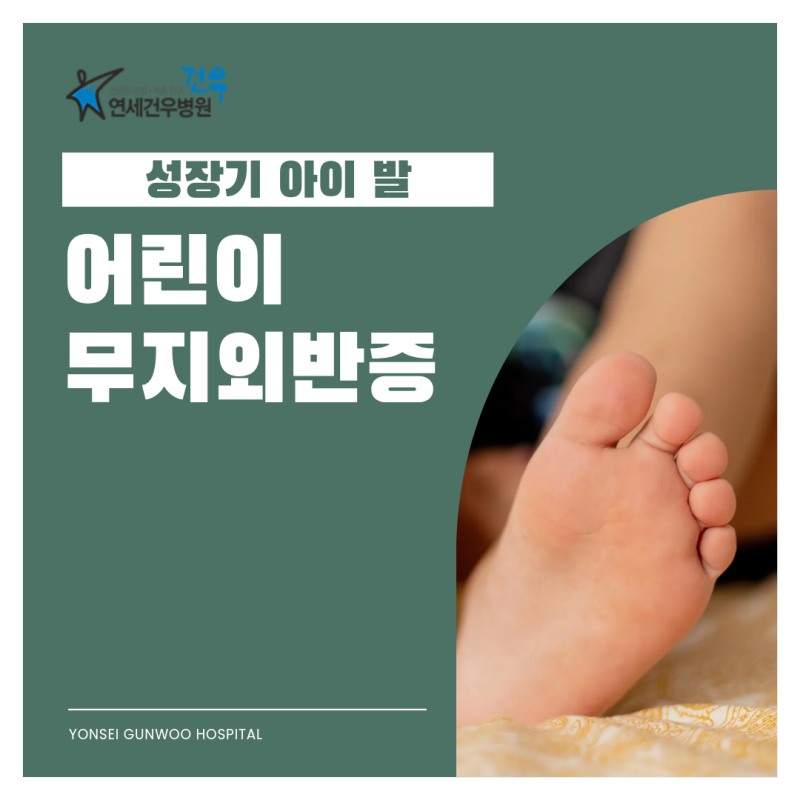 어린이무지외반증 성장기 아이 발에서 나타나는 작은 변화