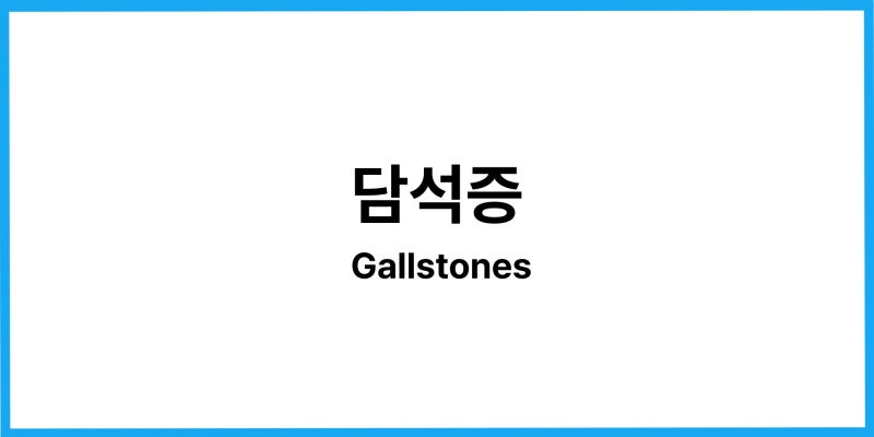 담석증 Gallstones
