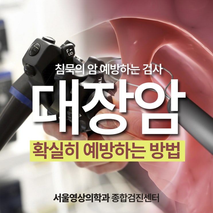  경기도광주 대장내시경, 침묵의 암 대장암을 막는 가장 확실한 예방
