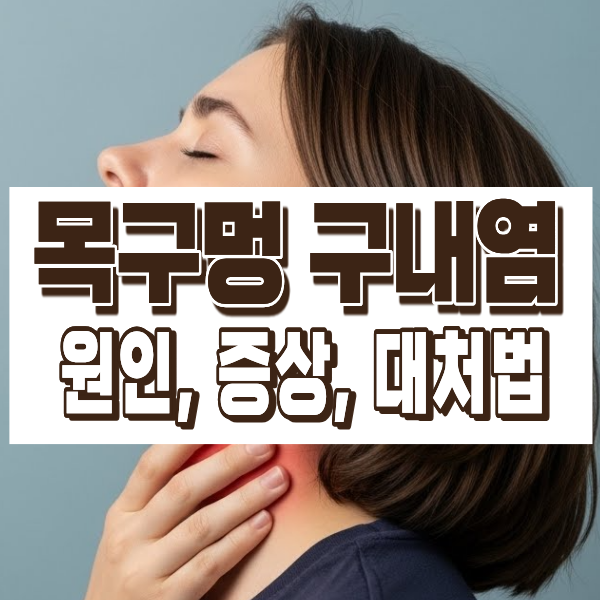 목구멍 구내염 원인 증상 빠른 대처법