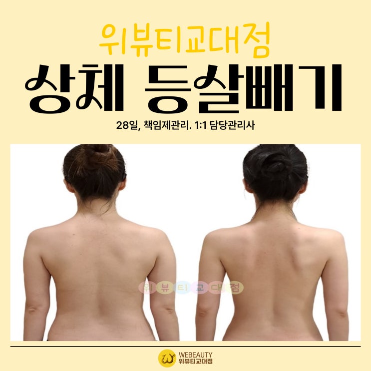  서초교대 경락] 겨울이 되면 ‘상체등살’이 더 도드라져 보이는 이유와 등살빼