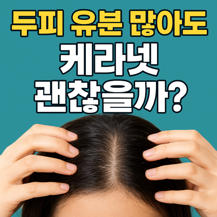  두피 유분 많은 사람도 케라넷 복용해도 될까? | 복용 전 꼭 알아야 할 포인트