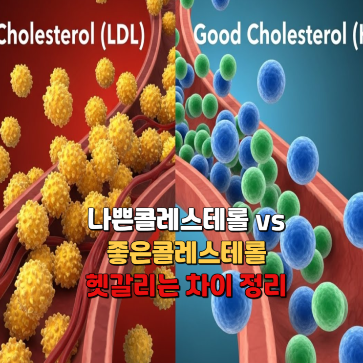  나쁜콜레스테롤 vs 좋은콜레스테롤, 헷갈리는 차이 정리