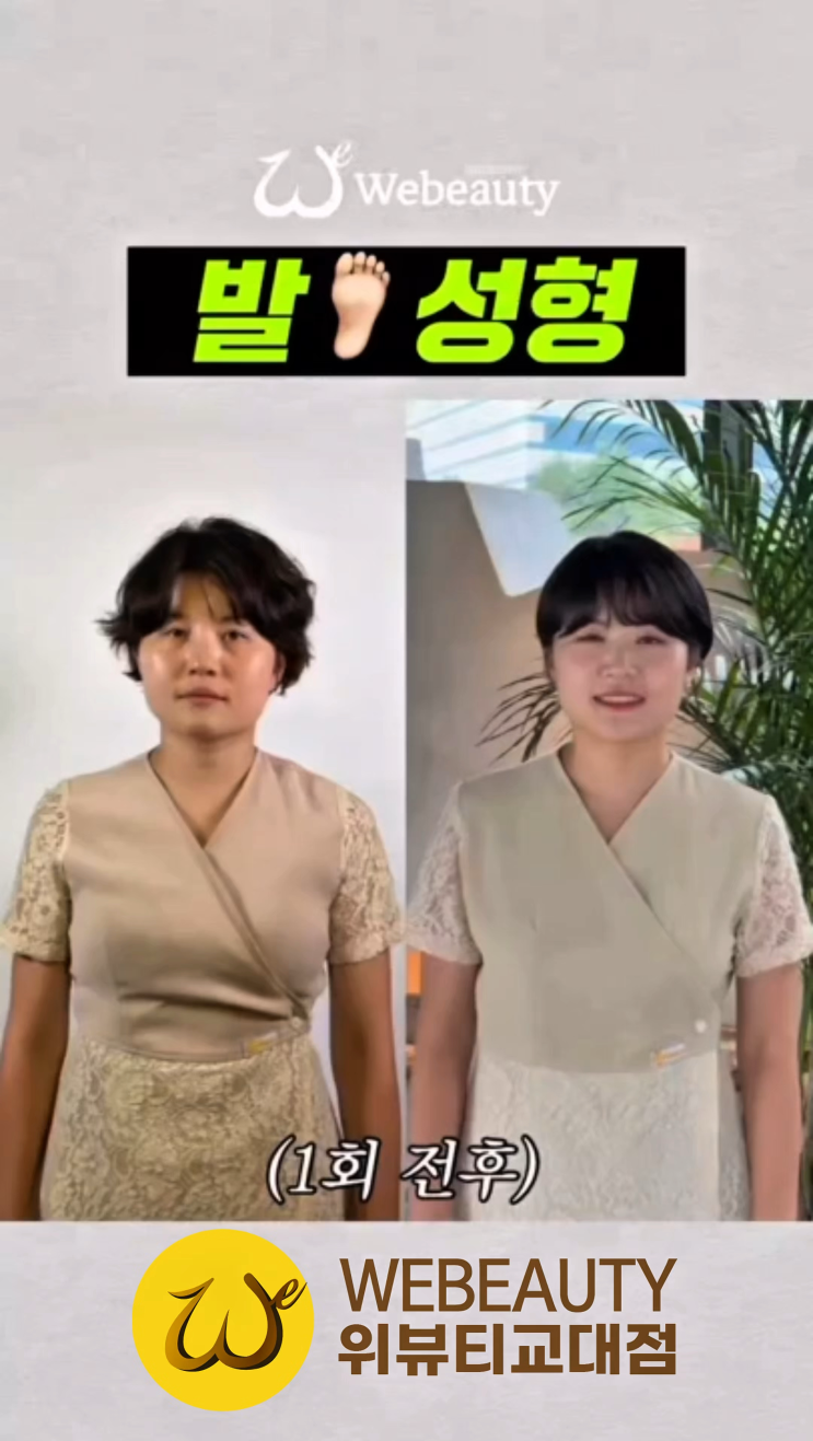  서초교대 경락] 발로하는 피부관리(발사지) 위뷰티 전후 효과/변화