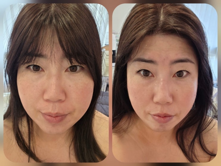  [장유율하]물광관리에 윤곽관리는 서비스로 받을 수 있는 율하피부관리 '아이스킨유 김해율하점'