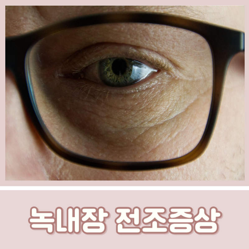 녹내장 전조증상 갑자기 흐려보이는 이유와 안압 낮추는 법