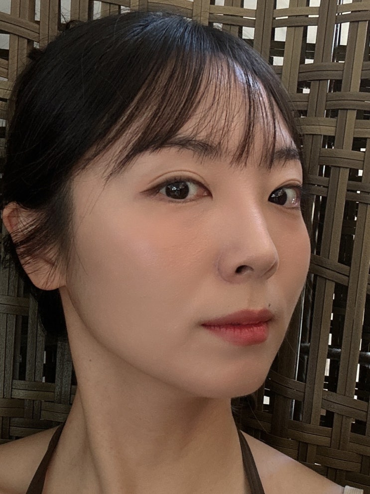  강남 티타늄리프팅 잘하는곳 볼패임, 팔자주름에 효과 봤어요