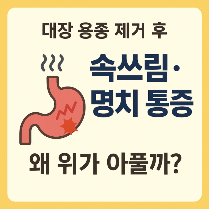 대장 용종 제거 후 속쓰림·명치 통증 왜 위가 아플까? 정상·위험 신호 완전 정리