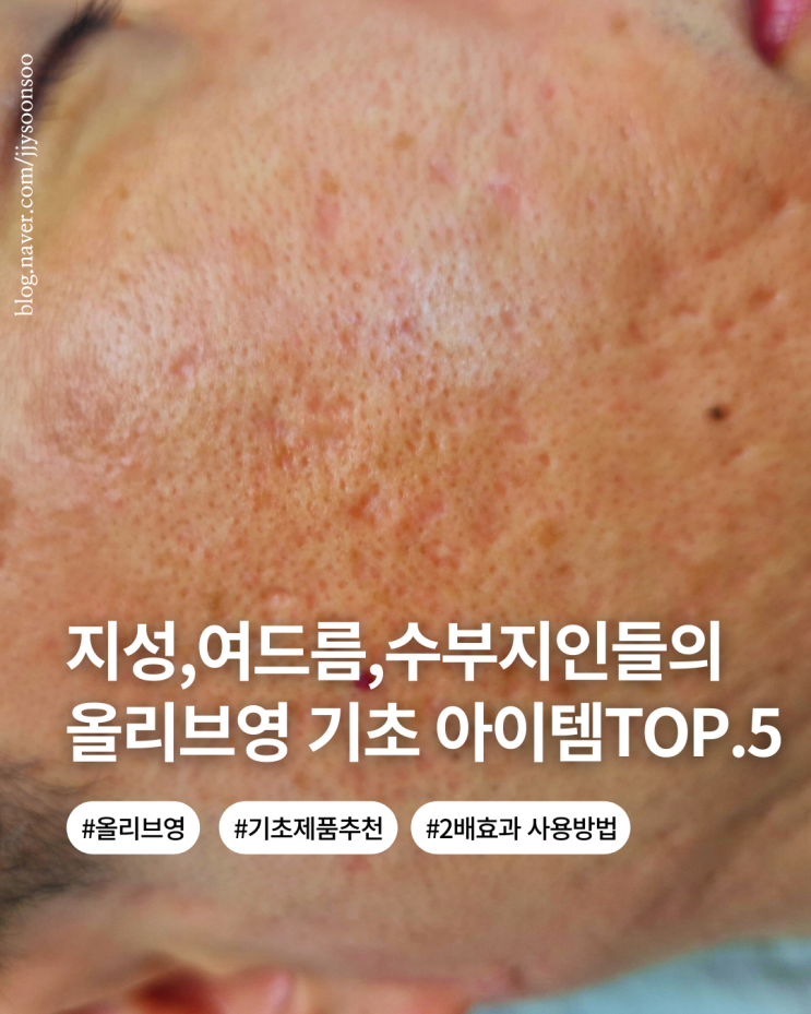  지성 여드름 수부지 추천 올리브영 기초 제품템 TOP.5 사용후기 사용방법