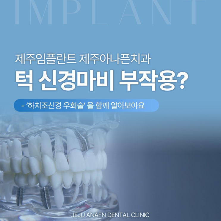  제주임플란트 부작용 턱 신경마비 없게 하치조신경 우회술로