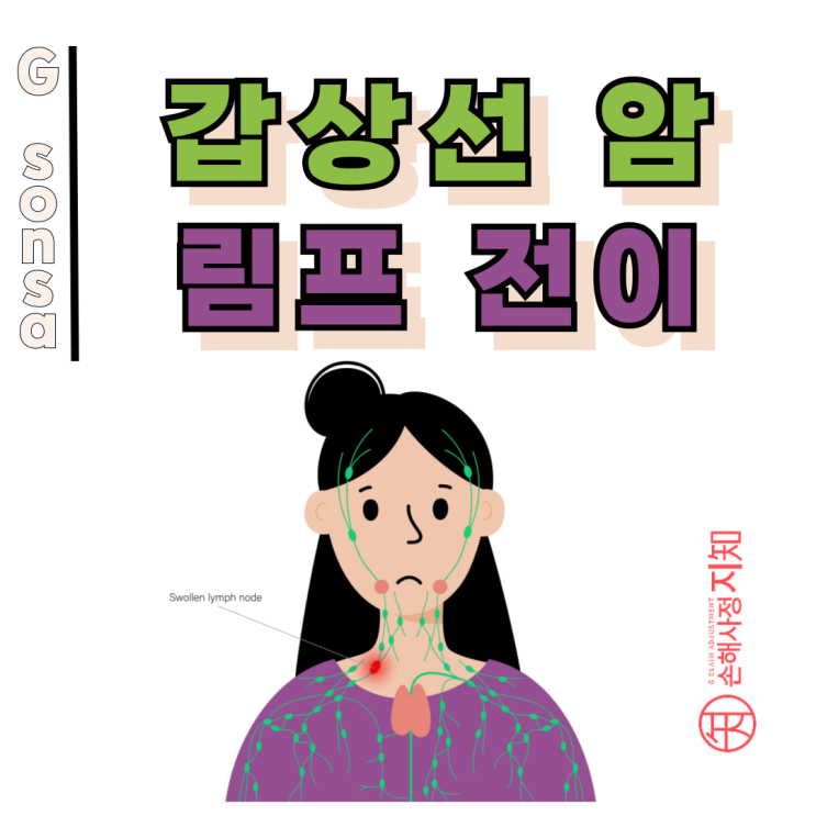  갑상선암 림프전이 – 이제 소액암 말고 일반암 받을 수 있습니다.