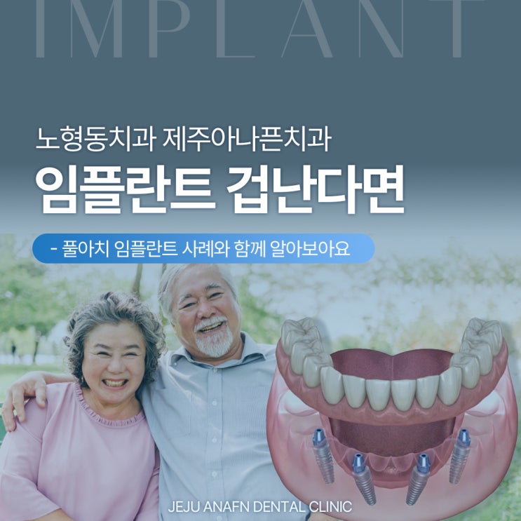  노형동치과 선택, 임플란트 많이 심는 게 겁나시는 분들께 (풀아치 사례)
