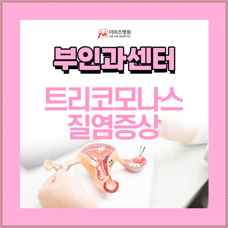트리코모나스 질염 증상 남자도 같이 치료해야