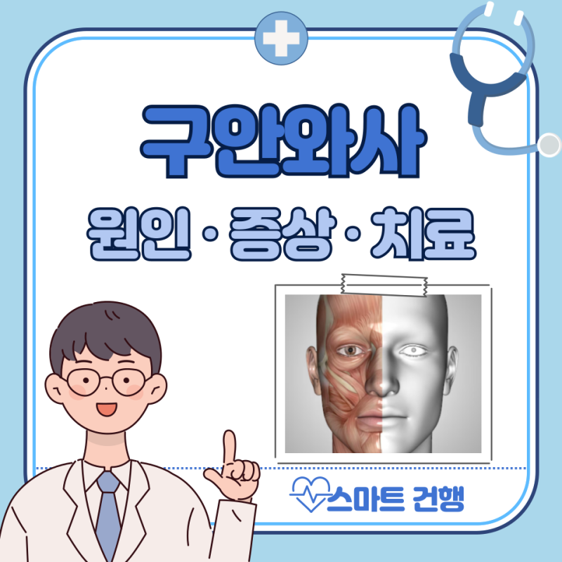 구안와사 전조증상 및 원인, 치료 방법과 약 정리
