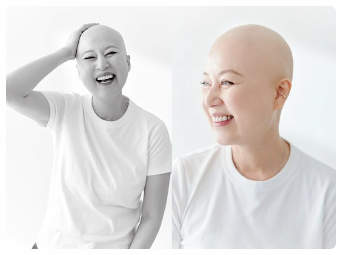 코미디언 박미선 유방암 2차 항암 투병치료중 결국 삭발 선택 매드맥스 퓨리오사처럼