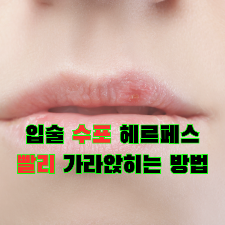  입술 옆 수포 물집 터짐, 전염될까? 헤르페스 증상 관리방법