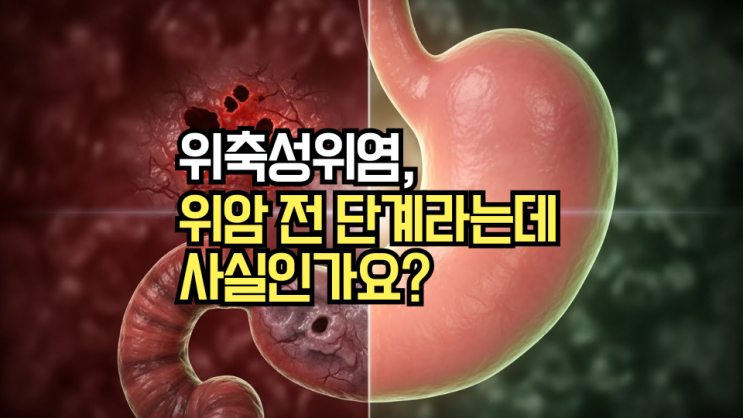  위축성위염, 위암의 전 단계? 소름 돋는 진실과 위장 건강 회복 솔루션 3가지