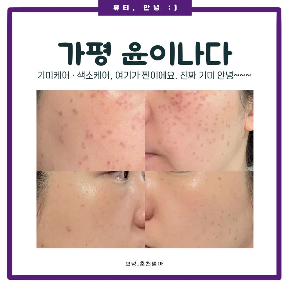 윤이나다 사진 4