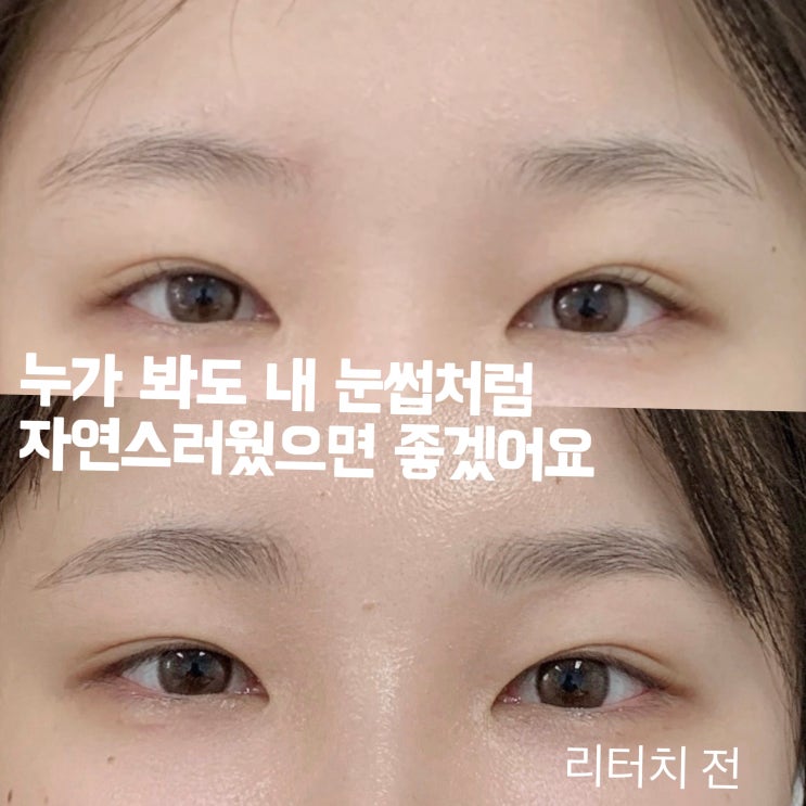  응암눈썹문신 응암남자눈썹문신 안아픈곳 찾으세요?