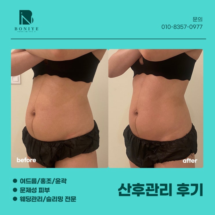  산전필라테스만으로 부족했던  이유 그리고 대구 보니예 산전·산후 관리가 필요한 순간